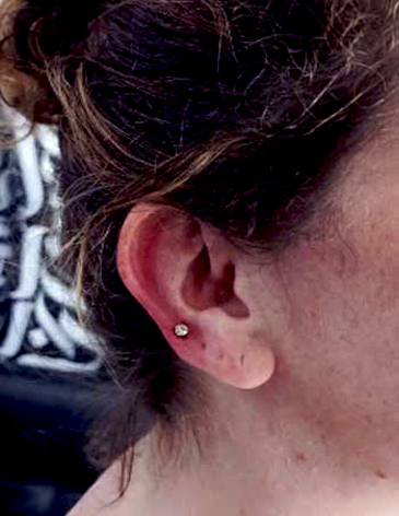 Upper Lobe Piercing